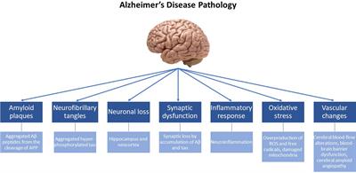 Natural antioxidants that act against Alzheimer’s disease through modulation of the NRF2 pathway: a focus on their molecular mechanisms of action